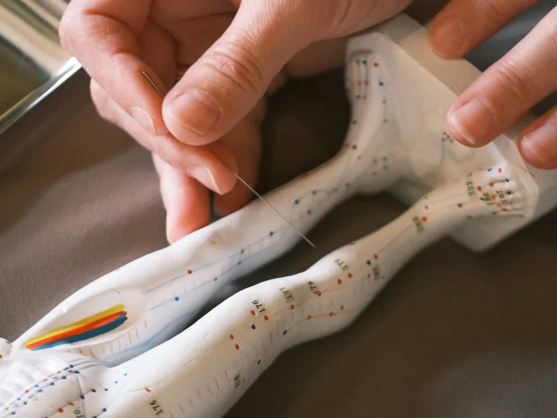 Acupuncture at Complete Chiropractic Sports & Wellness in Durham