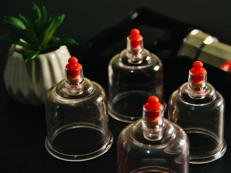 How Cupping Therapy works at Complete Chiropractic Sports & Wellness