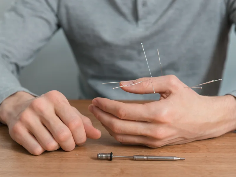 Dry Needling at Complete Chiropractic Sports & Wellness in Durham