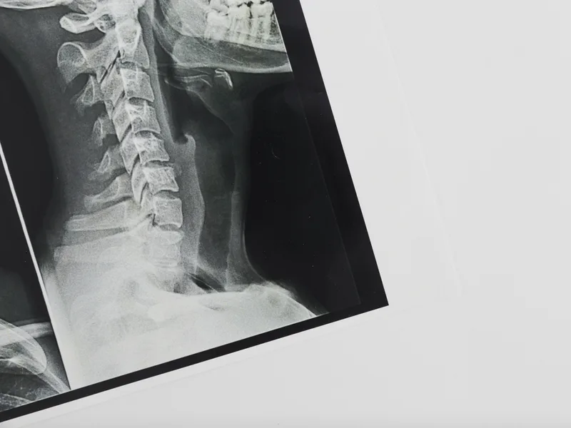 X-Rays at Complete Chiropractic Sports & Wellness in Durham
