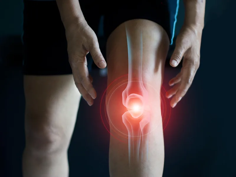 How Complete Chiropractic Sports & Wellness treats arthritis in Durham